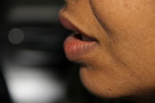 Mundgeruch - Foetor ex ore oder Halitosis