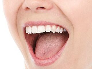 Ständig Mundgeruch durch Belegte Zunge